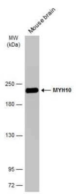 non-muscle heavy chain 10 Myosin Antibody (GT246), Novus Biologicals 100
