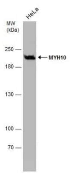 non-muscle heavy chain 10 Myosin Antibody (GT246), Novus Biologicals 100