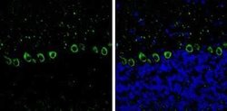 non-muscle heavy chain 10 Myosin Antibody (GT324), Novus Biologicals 100 &mu;g | Buy Online | Bio-Techne | Fisher Scientific