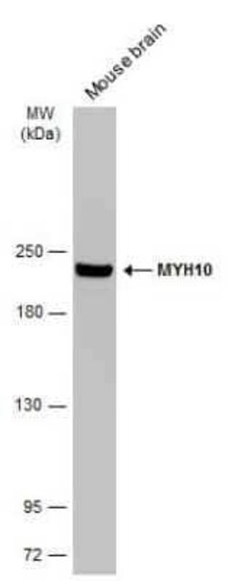 non-muscle heavy chain 10 Myosin Antibody (GT324), Novus Biologicals 100 &mu;g | Buy Online | Bio-Techne | Fisher Scientific