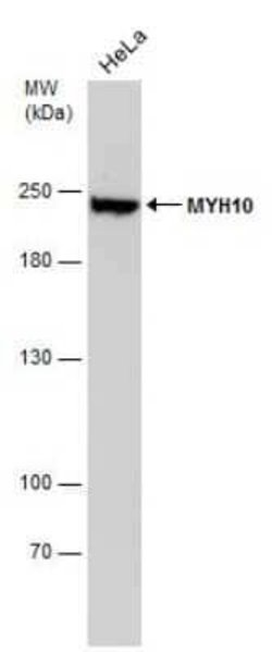non-muscle heavy chain 10 Myosin Antibody (GT324), Novus Biologicals 100 &mu;g | Buy Online | Bio-Techne | Fisher Scientific