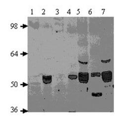 PDE7A Antibody, Novus Biologicals:Antibodies:Primary Antibodies