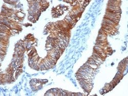 p120-catenin Antibody (CTNND1/4383R) - Azide and BSA Free, Novus Biologicals