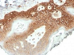 p120-catenin Mouse anti-Human, Clone: CTNND1/4501, Novus Biologicals:Antibodies:Primary