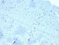 p120-catenin Mouse anti-Human, Clone: CTNND1/4501, Novus Biologicals:Antibodies:Primary