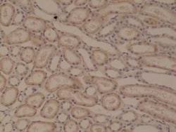 p120-catenin Antibody (RM353), Novus Biologicals 100 &mu;g, Unconjugated:Antibodies,