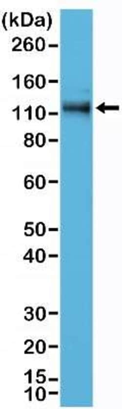 p120-catenin Antibody (RM353), Novus Biologicals 100 &mu;g, Unconjugated:Antibodies,