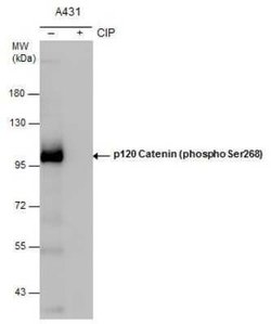 p120-catenin, p Ser268 Antibody, Novus Biologicals 100 &mu;g; Unconjugated:Antibodies,