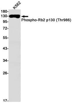 p130, p Thr986 Antibody (S06-9B3), Novus Biologicals 100 &mu;g | Buy Online | Novus Biologicals | Fisher Scientific