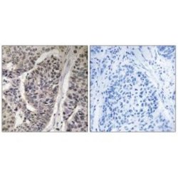 p130Cas/BCAR1, p Tyr410 Antibody - BSA Free, Novus Biologicals p130Cas/BCAR1