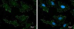 p130Cas/BCAR1, p Tyr165 Antibody, Novus Biologicals 100 μg; Unconjugated:Antibodies,