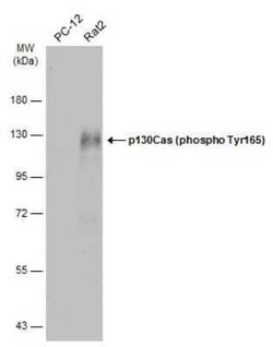 p130Cas/BCAR1, p Tyr165 Antibody, Novus Biologicals 100 μg; Unconjugated:Antibodies,