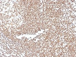 p16INK4a/CDKN2A Mouse anti-Human, Clone: CDKN2A/3830, Novus Biologicals:Antibodies:Primary