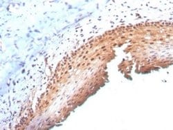 p16INK4a/CDKN2A Mouse anti-Human, Clone: CDKN2A/3830, Novus Biologicals:Antibodies:Primary