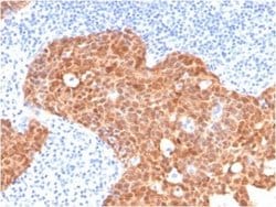 p16INK4a/CDKN2A Mouse anti-Human, Clone: CDKN2A/4499, Novus Biologicals:Antibodies:Primary