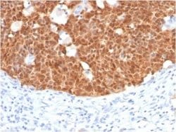 p16INK4a/CDKN2A Mouse anti-Human, Clone: CDKN2A/4499, Novus Biologicals:Antibodies:Primary