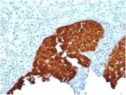p16INK4a/CDKN2A Rabbit anti-Human, Clone: CDKN2A/4844R, Novus Biologicals