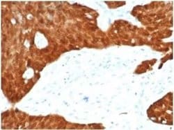 p16INK4a/CDKN2A Rabbit anti-Human, Clone: CDKN2A/7081R, Novus Biologicals:Antibodies:Primary