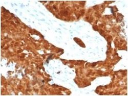 p16INK4a/CDKN2A Rabbit anti-Human, Clone: CDKN2A/7081R, Novus Biologicals:Antibodies:Primary