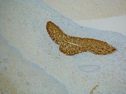 p16INK4a/CDKN2A Mouse anti-Human, Clone: R15-A, Novus Biologicals:Antibodies:Primary