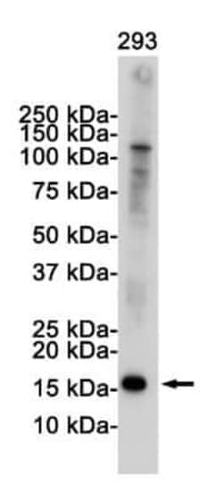 p16INK4a/CDKN2A Rabbit anti-Human, Mouse, Clone: S04-8C9, Novus Biologicals 100 &mu;g | Buy Online | Novus Biologicals | Fisher Scientific