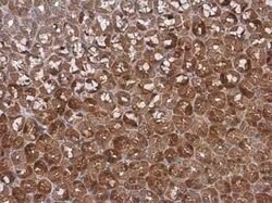 p18INK4c/CDKN2C Antibody, Novus Biologicals 100 &mu;g | Buy Online | Novus Biologicals | Fisher Scientific