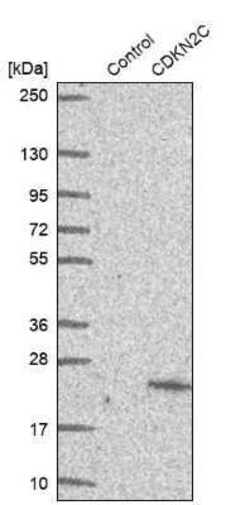 p18INK4c/CDKN2C Antibody, Novus Biologicals 0.1 mL; Unconjugated:Antibodies,