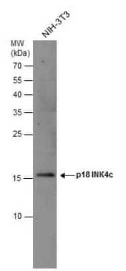 p18INK4c/CDKN2C Antibody, Novus Biologicals 100 &mu;g | Buy Online | Novus Biologicals | Fisher Scientific