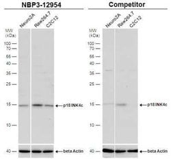 p18INK4c/CDKN2C Antibody, Novus Biologicals 100 &mu;g | Buy Online | Novus Biologicals | Fisher Scientific