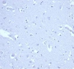 p21/CIP1/CDKN1A Antibody (CIP1/4377R) - Azide and BSA Free, Novus Biologicals 100 &mu;g | Buy Online | Novus Biologicals | Fisher Scientific