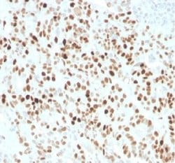 p21/CIP1/CDKN1A Rabbit anti-Human, Clone: CIP1/4377R, Novus Biologicals