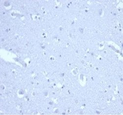 p21/CIP1/CDKN1A Rabbit anti-Human, Clone: CIP1/4377R, Novus Biologicals