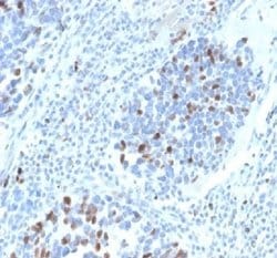 p21/CIP1/CDKN1A Rabbit anti-Human, Clone: CIP1/4377R, Novus Biologicals