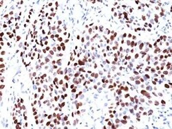 p21/CIP1/CDKN1A Antibody (CIP1/823), Novus Biologicals:Antibodies:Primary