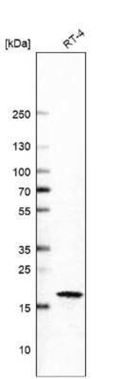 p21/CIP1/CDKN1A Antibody (CL13081), Novus Biologicals:Antibodies:Primary