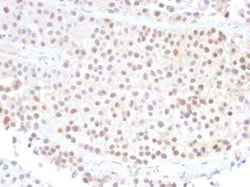 p21/CIP1/CDKN1A Antibody (DCS-60.2), Novus Biologicals:Antibodies:Primary
