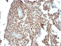 p21/CIP1/CDKN1A Antibody (SPM306), Novus Biologicals:Antibodies:Primary