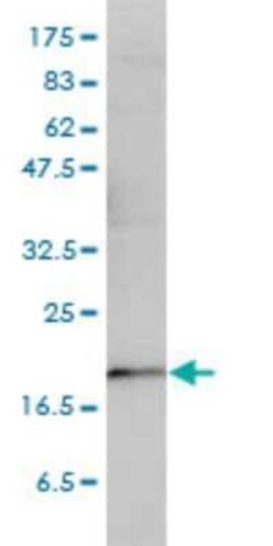 p23/PTGES3 Antibody (3H1-2A8), Novus Biologicals 0.1 mg | Buy Online | Novus Biologicals | Fisher Scientific