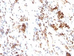 p27/Kip1 Antibody (DCS-72.F6), Novus Biologicals:Antibodies:Primary Antibodies