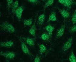 p38 beta/MAPK11 Antibody (E13-Q), Novus Biologicals 50 &mu;g | Buy Online | Novus Biologicals | Fisher Scientific