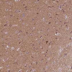 p38 beta/MAPK11 Antibody, Novus Biologicals:Antibodies:Primary Antibodies