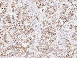 p38 beta/MAPK11 Antibody, Novus Biologicals:Antibodies:Primary Antibodies