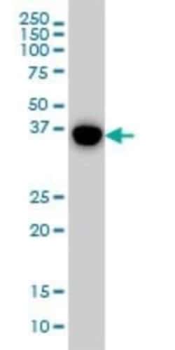 p38 delta/SAPK4 Antibody (1E11), Novus Biologicals 0.1 mg | Buy Online | Novus Biologicals | Fisher Scientific