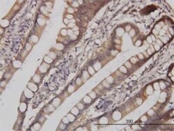 p38 delta/SAPK4 Antibody (2B2), Novus Biologicals 0.1 mg | Buy Online | Novus Biologicals | Fisher Scientific