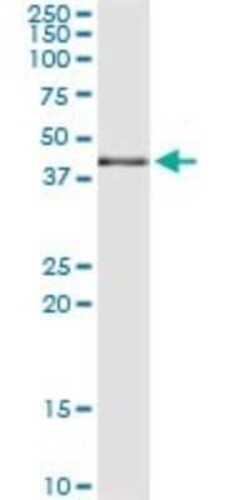 p38 delta/SAPK4 Antibody (2B6), Novus Biologicals 0.1 mg | Buy Online | Novus Biologicals | Fisher Scientific