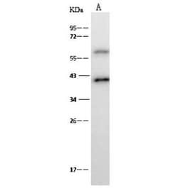 p40 Antibody, Novus Biologicals 100 &mu;g; Unconjugated:Antibodies, Polyclonal