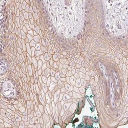 p53 AIP1 Antibody, Novus Biologicals 25 &mu;L, Unconjugated:Antibodies,