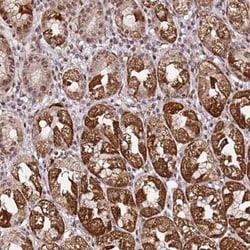p53 AIP1 Antibody, Novus Biologicals 25 &mu;L | Buy Online | Novus Biologicals | Fisher Scientific