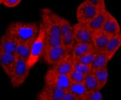 p53 Rabbit anti-Human, Clone: SY010-6, Novus Biologicals 100&mu;L:Antibodies,