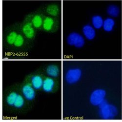 p53 Antibody (PAb421) - Chimeric - Azide and BSA Free, Novus Biologicals